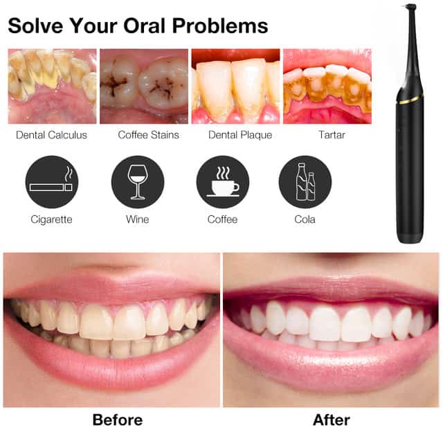 Détartreur électrique portable pour les dents, élimine le tartre et les taches, blanchiment, chargeur USB - صورة 2