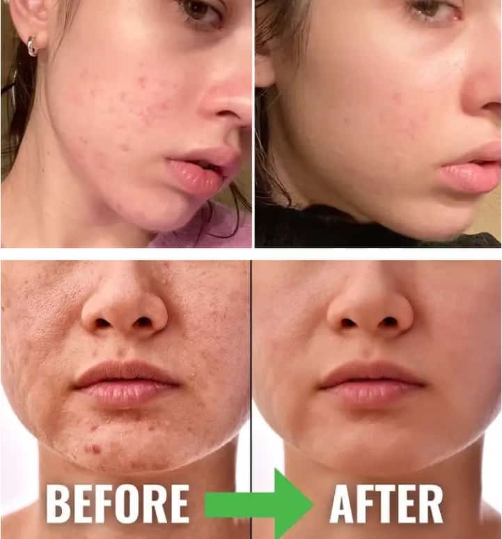 Madagascar Centella Tone Brightening Capsule Ampoule SKIN1004 - Authentique - صورة 5